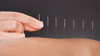 Les bienfaits de l’acupuncture et comment ça fonctionne