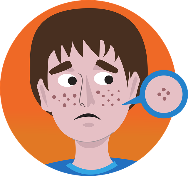 Les causes de l'acné chez l'adulte et comment s'en débarrasser